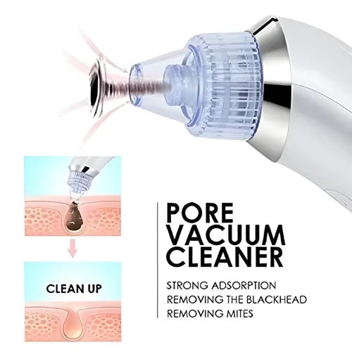 DermaSuction Pro – Deep Pore Blackhead Remover (Original)