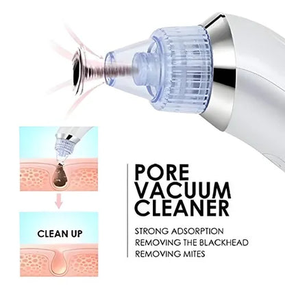 DermaSuction Pro – Deep Pore Blackhead Remover (Original)