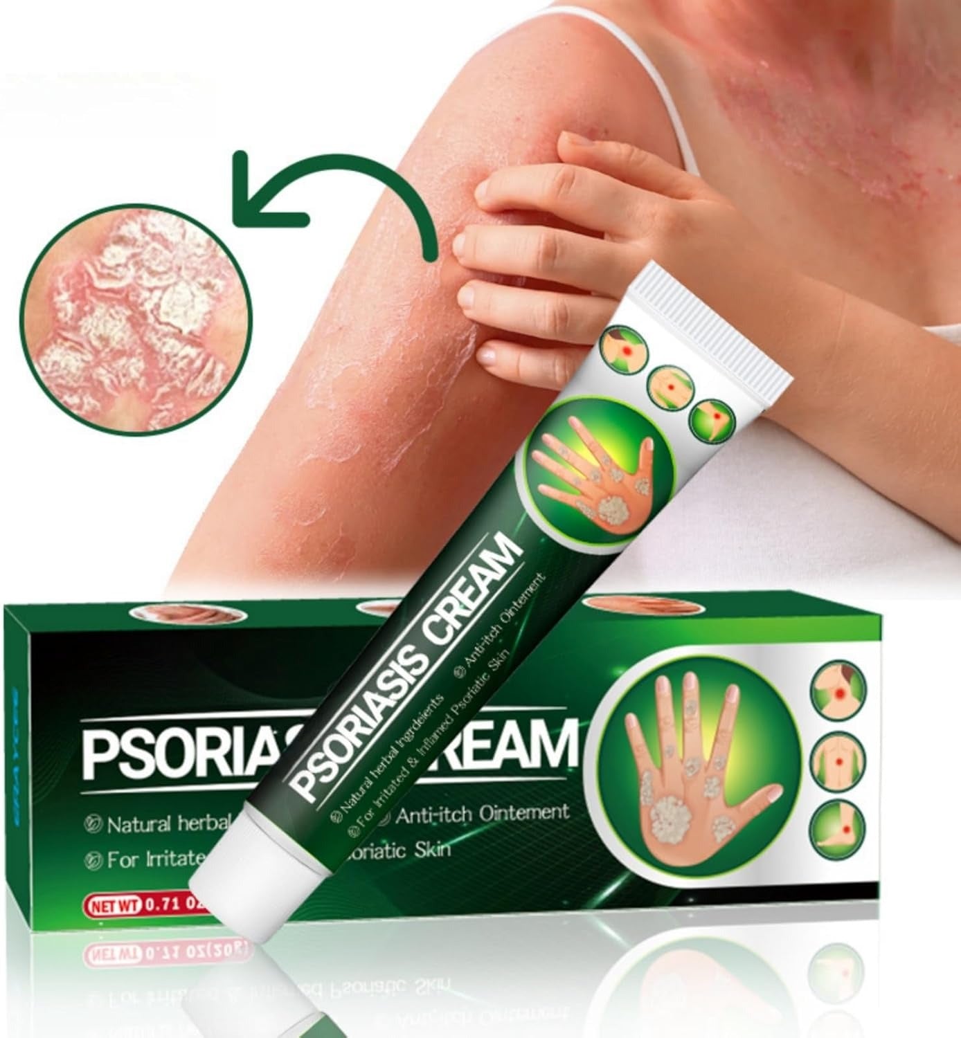 Psoriasis Cream (Original) – 20g Each (Pack of 2)
