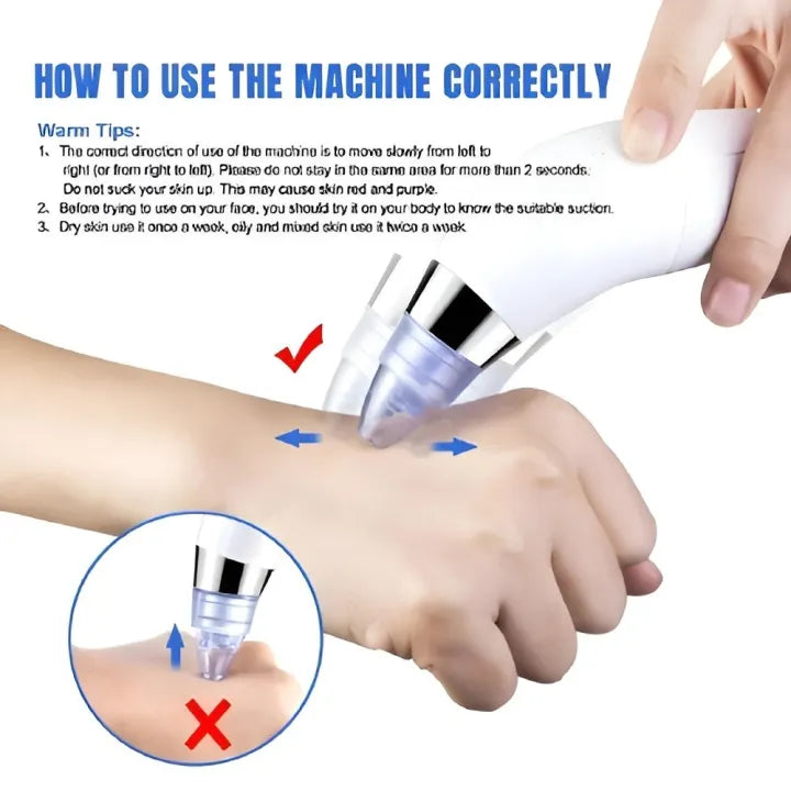 DermaSuction Pro – Deep Pore Blackhead Remover (Original)