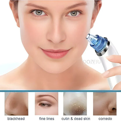 DermaSuction Pro – Deep Pore Blackhead Remover (Original)