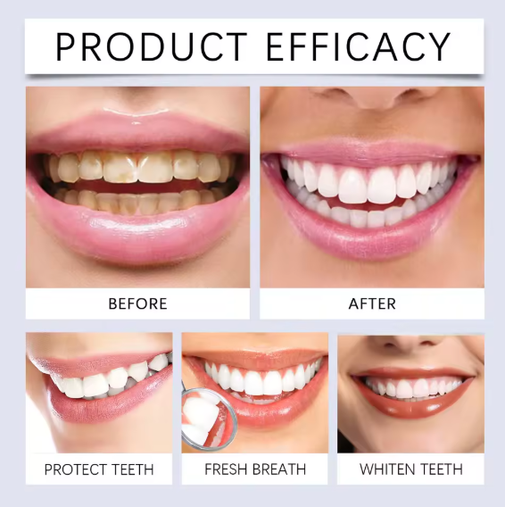 Oralhoe Nicotinamide Dazzle White Toothpaste (100g)