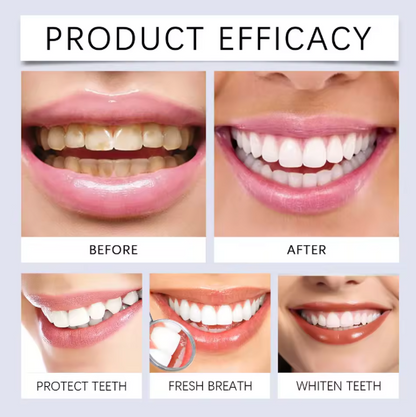 Oralhoe Nicotinamide Dazzle White Toothpaste (100g)