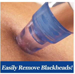 DermaSuction Pro – Deep Pore Blackhead Remover (Original)